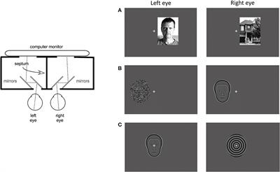 Atypical responses to faces during binocular rivalry in early glaucoma